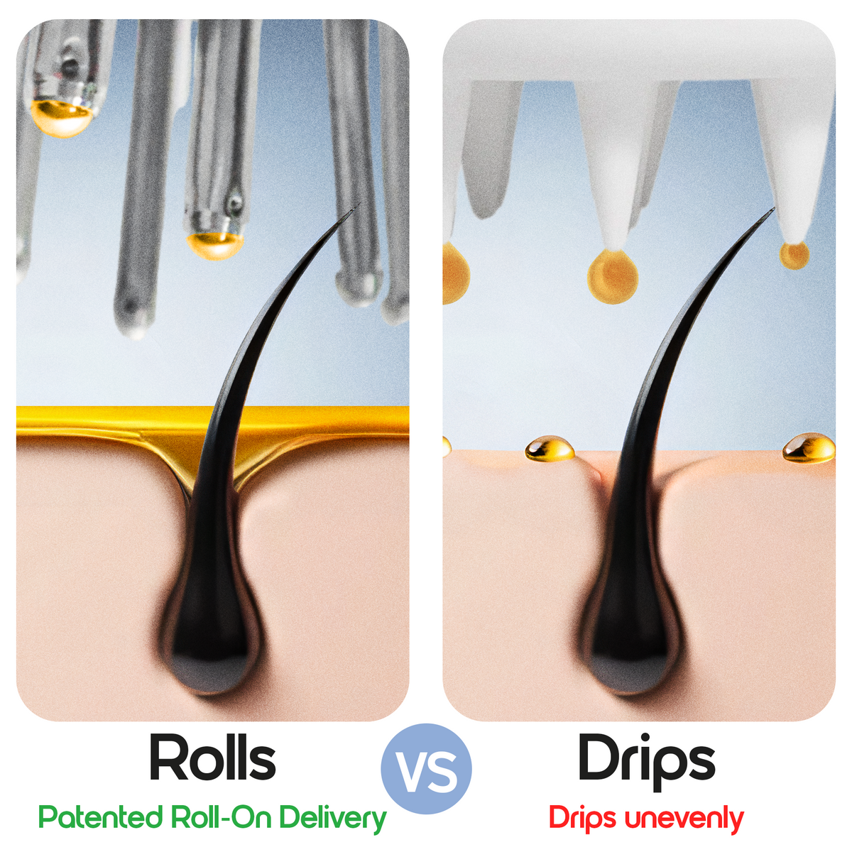 SCALP DIRECT™ Brush